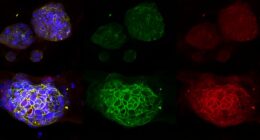 patient derived tumor organoids