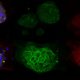 patient derived tumor organoids