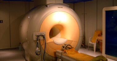MRI scanner.