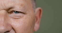 Ageing face.