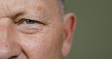 Ageing face.
