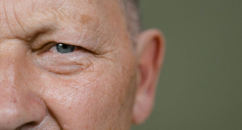 Ageing face.